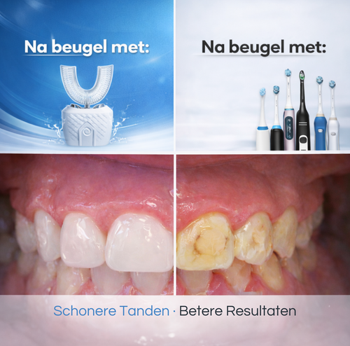 Haven One™ ThoothBrush