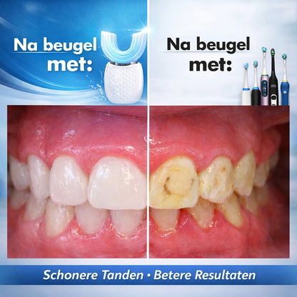 Haven One™ ThoothBrush