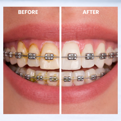 Haven One™ ThoothBrush