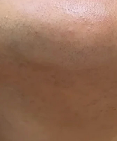 Na